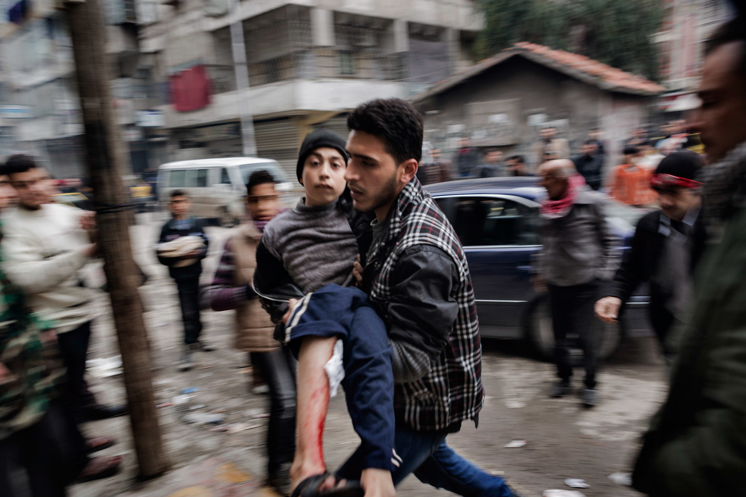 February 7, 2013, Shaar, Aleppo.
A hospital worker rushes a boy wounded by Syrian Government shelling into a field hospital.